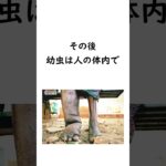 【奇病】実在する辛すぎる病気 #雑学 #病気