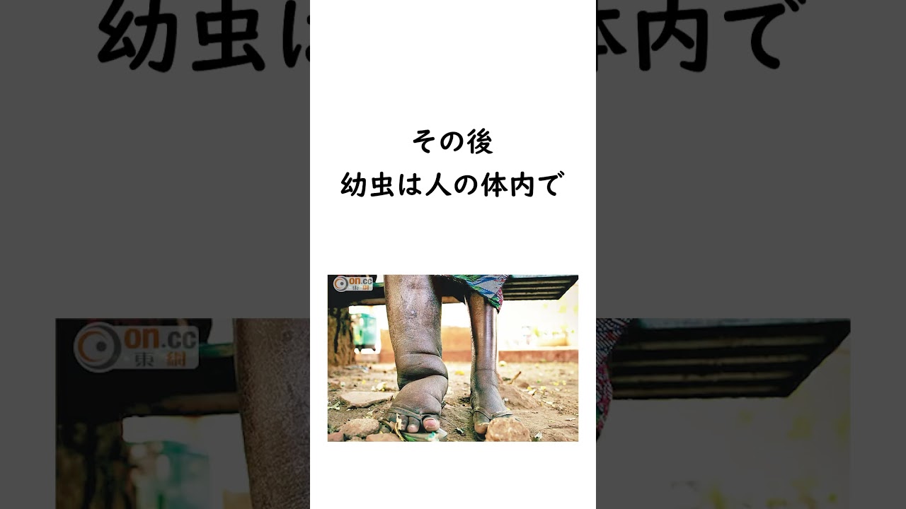 【奇病】実在する辛すぎる病気 #雑学 #病気