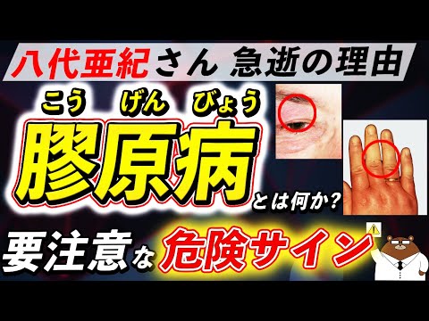 放置厳禁!知らないと後悔する「膠原病」が引き起こす体の変化。なぜ八代亜紀さんは急逝したのか。初期の危険サインとは?医師が徹底解説!