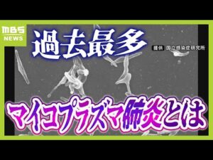 【マイコプラズマ肺炎って？】８年ぶり感染拡大で『過去最多』...症状消えても感染力あり「歩く肺炎」とも　実は「うがい」はあまり予防効果なし！？（2024年10月9日）