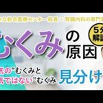 【むくみの原因】”病気”のむくみと”病気ではない”むくみの見分け方を教えます