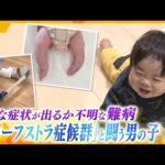 国内の患者はわずか100人…知られていないからこその困難「両親がいなくなったとしても助けてくれる社会があってほしい」 難病・クリーフストラ症候群と向き合う親子【かんさい情報ネット ten.特集】