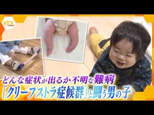 国内の患者はわずか100人…知られていないからこその困難「両親がいなくなったとしても助けてくれる社会があってほしい」 難病・クリーフストラ症候群と向き合う親子【かんさい情報ネット ten.特集】