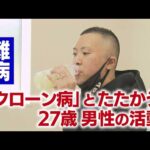 難病「クローン病」とたたかう27歳男性の活動