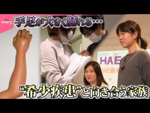 【難病】“知ってほしい希少疾患”患者が少なく診断遅れも…診断が遅れ夫を亡くした家族や病と前向きに向き合う女性の挑戦『every.特集』