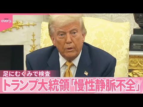 【トランプ大統領】「慢性静脈不全」足にむくみで検査 どんな病気なのか