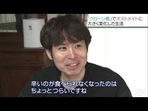 国指定難病「クローン病」と歩む男性　30代前半で人工肛門造設のオストメイトに　「ケア、対策で旅行も趣味も」患者会で発信