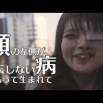【顔の左側の骨が成長しない病】それでも大好きなメイクで夢を追いかける女性の1日 supported by にしたんARTクリニック#にしたんARTクリニック #にしたんクリニック  #共生社会 #顔