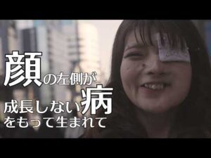 【顔の左側の骨が成長しない病】それでも大好きなメイクで夢を追いかける女性の1日 supported by にしたんARTクリニック#にしたんARTクリニック #にしたんクリニック #共生社会 #顔