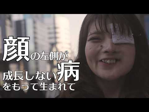 【顔の左側の骨が成長しない病】それでも大好きなメイクで夢を追いかける女性の1日 supported by にしたんARTクリニック#にしたんARTクリニック #にしたんクリニック #共生社会 #顔