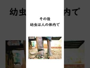 【奇病】実在する辛すぎる病気 #雑学 #病気