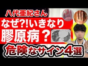 【八代亜紀さん急逝】危険な膠原病のサインとは？知らないと後悔します。【医師解説】
